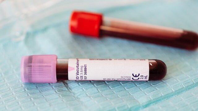 health checks like blood tests are important to monitor your health
